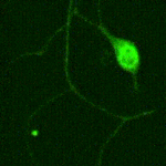 optical tweezers confocal imaging of neuron