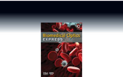 The characterization of cell membrane elasticity as a new potential biomarker for leukemia cells with IMPETUX technology