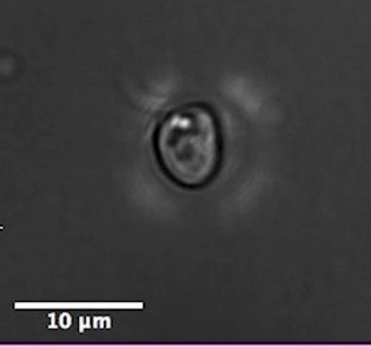 Stochastic force dynamics generated by a Chlamydomonas microswimmer study with IMPETUX’s exclusive patented technology